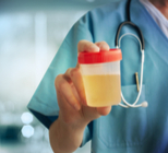 בדיקת שתן - תמונה